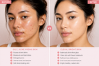 PDRN Pink Facial Cleanser